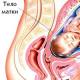Тонус матки при беременности: симптомы, повышенный тонус шейки матки Тонус матки что делать