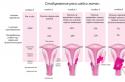 Рак шейки матки: причины, стадии, лечение и прогноз Морфологические признаки рака шейки матки