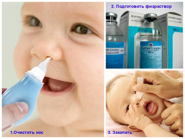 чем лечить сопельки у грудничка 5 месяцев