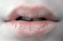 Бледные губы у ребенка причины Участок кожи на губе побелел