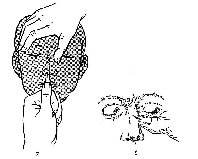 Запах железа в носу. Пальцевая репозиция костей носа. Перелом костей носа репозиция. Точки для восстановления обоняния.